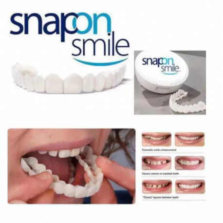 Виниры SnapOn Smile Veneers для зубов снеп он смайл 1 ЧЕЛЮСТЬ